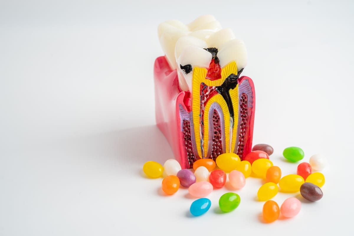 root-canal-vs-extraction-which-actually-saves-you-more-money