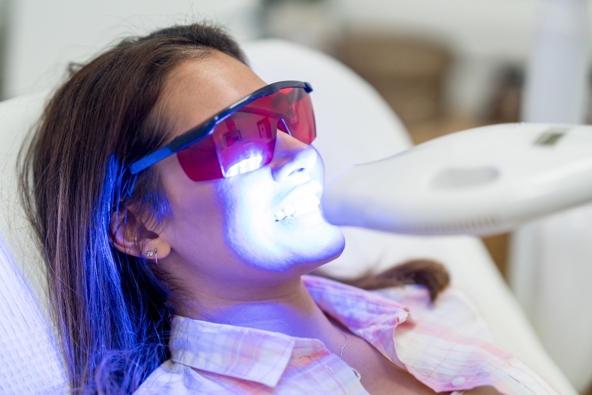 teeth-whitening-in-New-Port-Richey